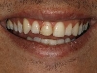 Konig Center for Cosmetic & Comprehensive Dentistry smile photos